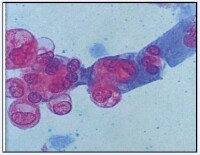 圖4 尿腎小管上皮細胞（S染色）