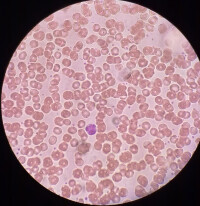 正常紅細胞電鏡圖