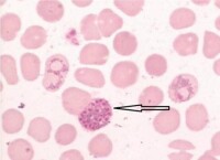 Plasmodium Falciparum的裂殖子