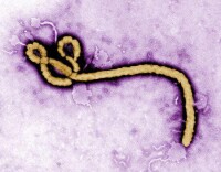埃博拉病毒結構形態