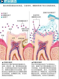 含氟牙膏作用示意圖