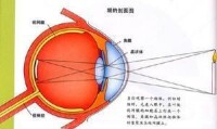 視網膜