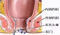 氣虛脫肛