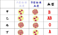 動物血型