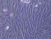 纖維細胞