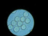光學顯微鏡下的紅細胞（未染色）