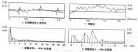 （圖）心房顫動動率譜：屈天祥患有該病