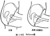 大轉子點高