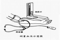 糖尿病腎臟病變