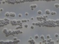 灰色鏈黴菌的特徵