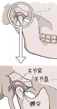 切斷髁狀突