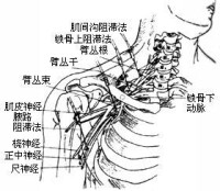 臂叢神經痛