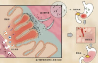 胃粘膜