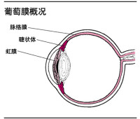 （圖）葡萄膜病