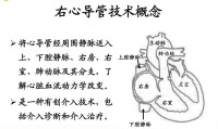 右心導管檢查術概念