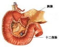 胰腺囊腺瘤和囊腺癌