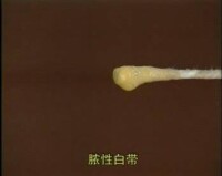 分泌物為黃色