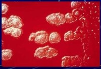炭疽芽孢桿菌在血瓊脂平板上的形態