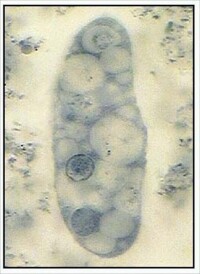 溶組織內阿米巴滋養體（右上為偽足）