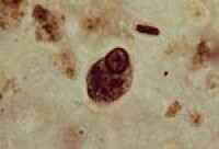 Entamoeba coli，內阿米巴屬之一種。