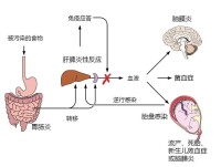 單核細胞增生李斯特氏菌