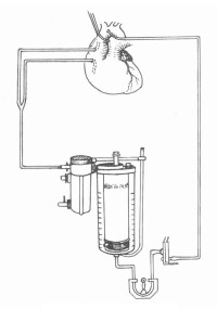 鼓泡式氧合器