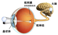人造視網膜