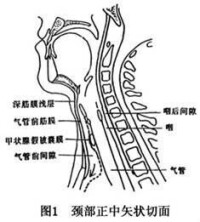 氣管前間隙