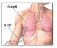 棉塵病