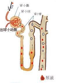 遠端型腎小管酸中毒