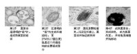 黑素體發展階段