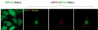 單標/雙標記LC3對比圖(點擊放大)