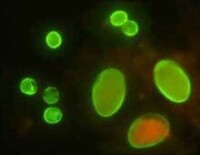 隱孢子蟲蟲卵熒光抗體染色