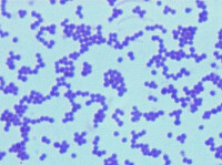 革蘭氏陽性球菌感染