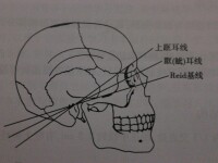 影像解剖常用基線