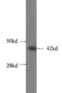 β-Actin