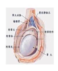 附睾鬱積症