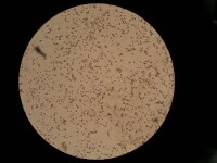 畢赤酵母顯微圖
