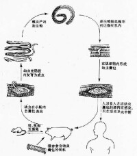 旋毛形線蟲