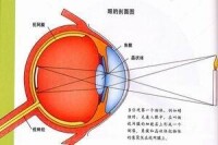 糖尿病性視網膜病