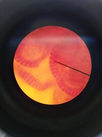 顯微鏡下的孢子