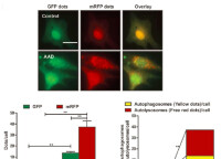 RFP-GFP-LC3的自噬流定量比較(點擊放大)